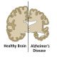 Researching Alzheimer's Disease by ELISA, Manufacturer reference: 1116
