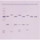 DNA Fingerprinting by Southern Blot, Manufacturer reference: 311*
