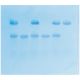 In Search of the Sickle Cell Gene by Southern Blot, Manufacturer reference: 315