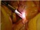 77905-07,     Lighted Mayo Scissor 17CM Blunt/Blunt Tip